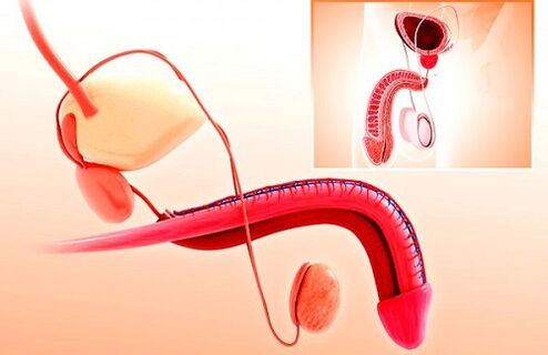 penile deformity and glans enlargement