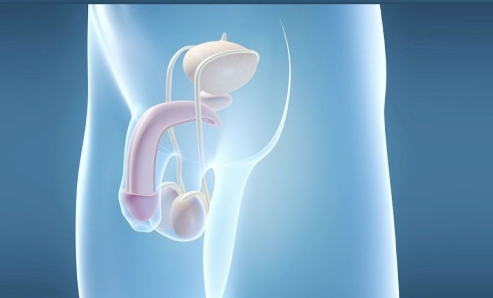 Prosthesis implantation is a surgical method of enlarging the male penis